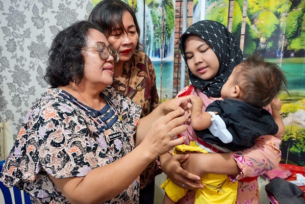 Kasus Stunting di Medan Sunggal Diaudit oleh Pemko Medan 